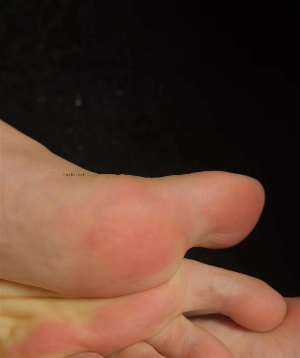 陈佩奇 – 裸足小脚丫【18P】